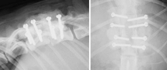 T12-13椎間の亜脱臼症例の術後X線検査(左:側方像、右:腹背像) 写真